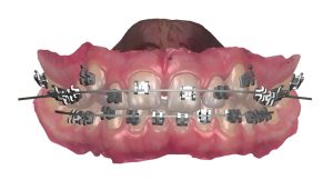 Orthodontic Planner