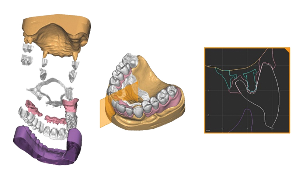 Ceramill Map 600