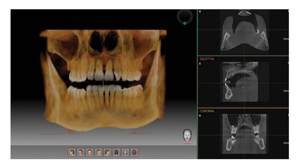 PaX-i 3D SMART