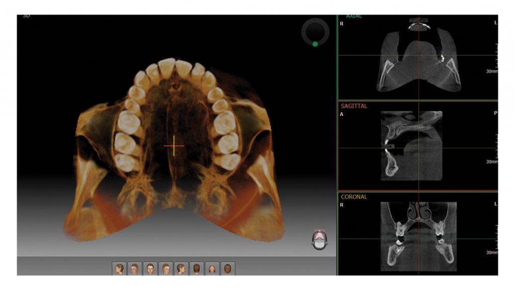 PaX-i 3D SMART