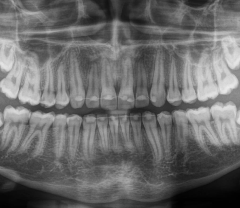 Dentsply Sirona Orthophos S (2D/3D)