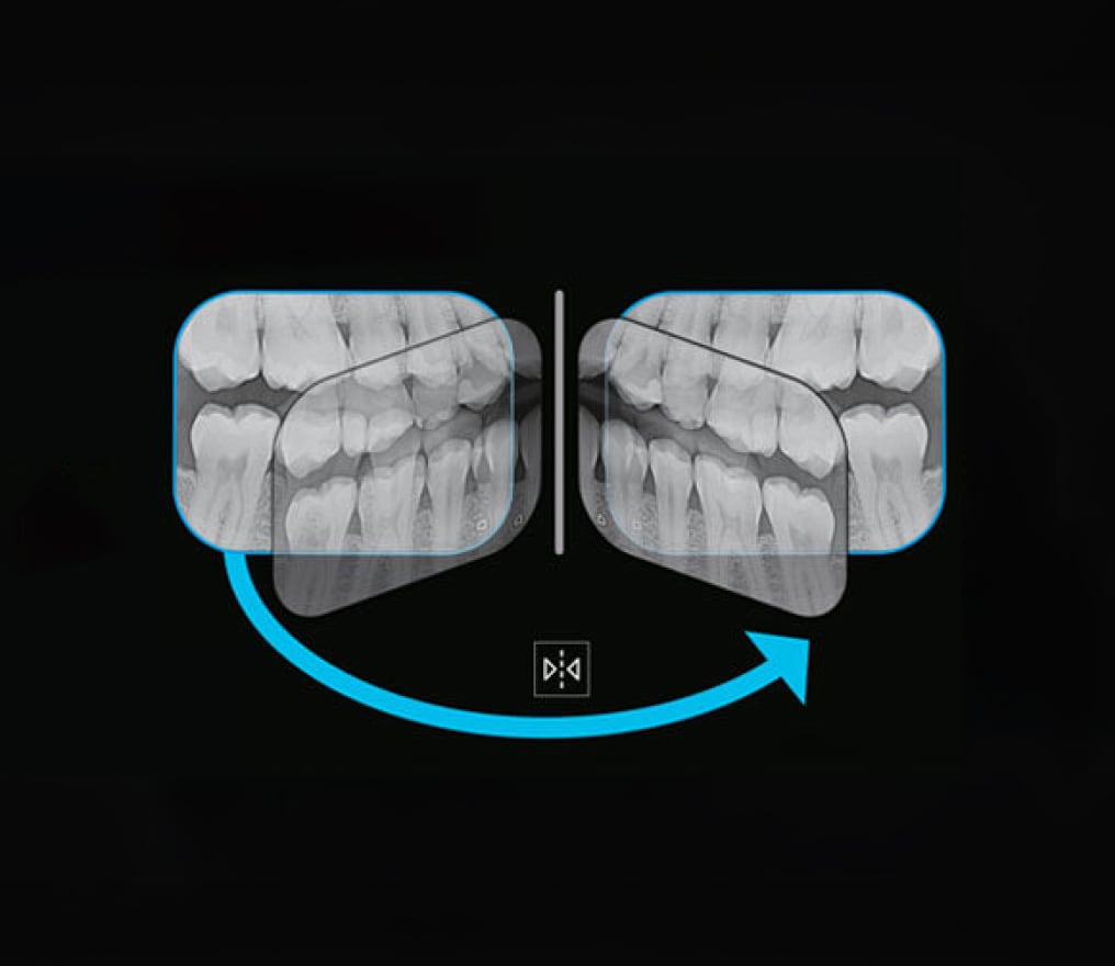 VistaScan Mini View 2.0